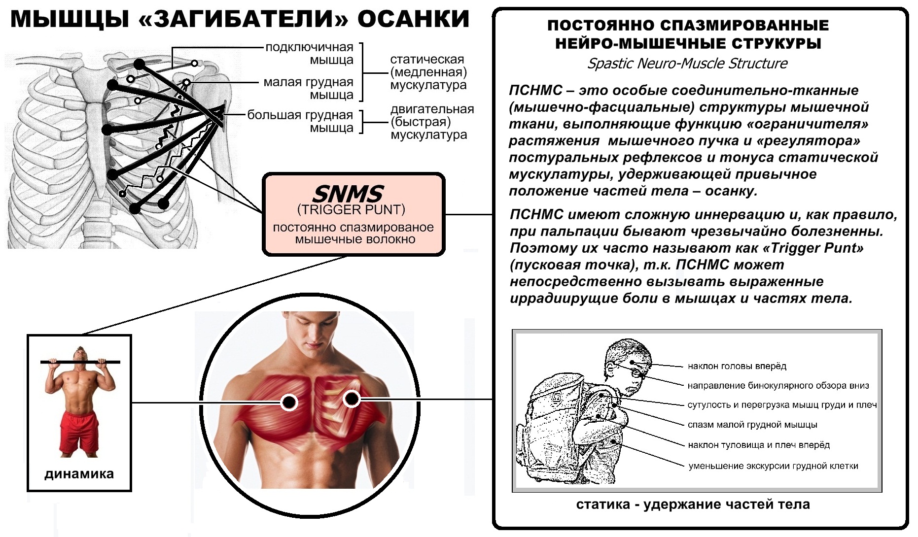 Спазмированная грудная мышца