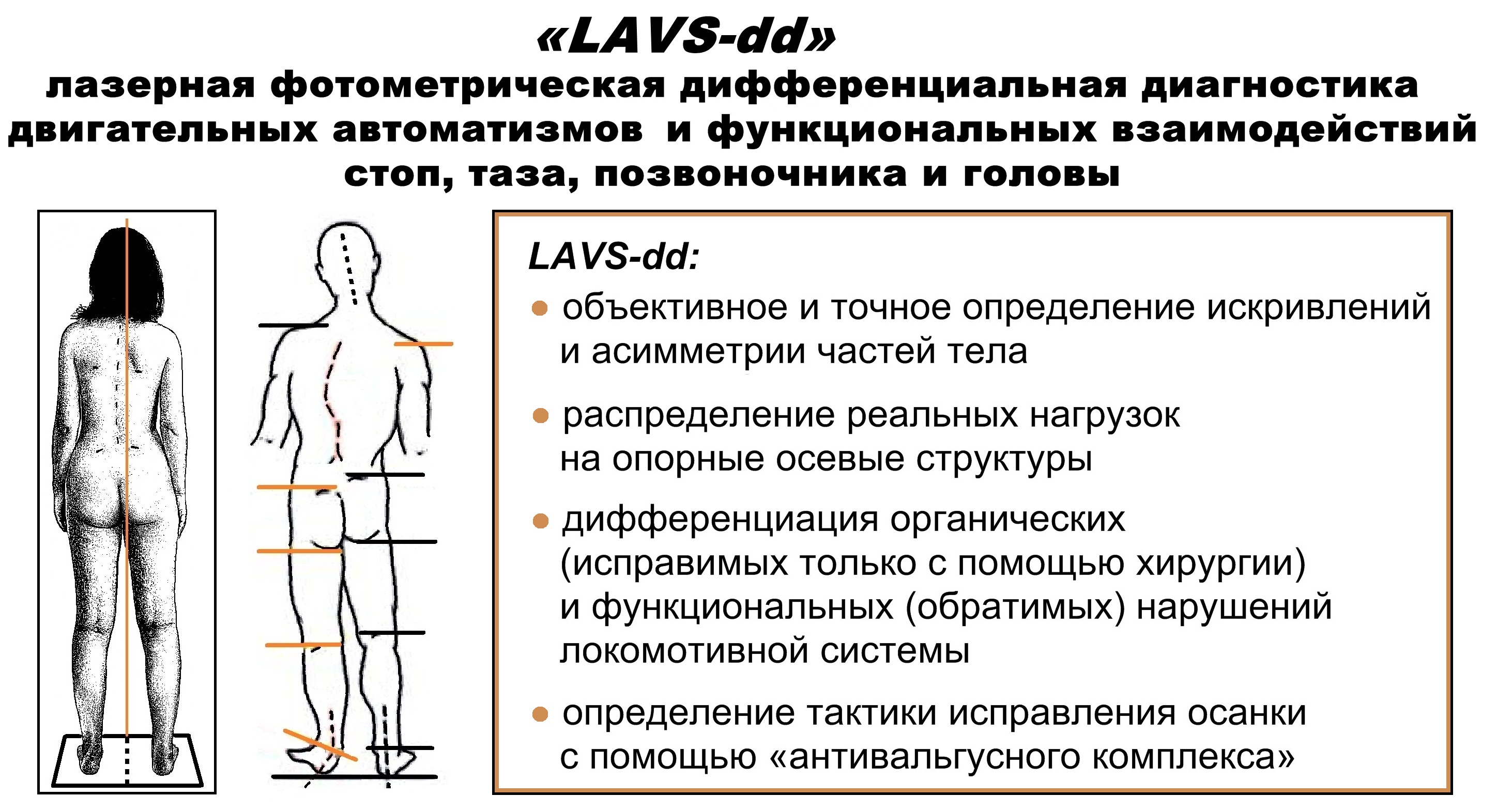 Искривление во фронтальной плоскости